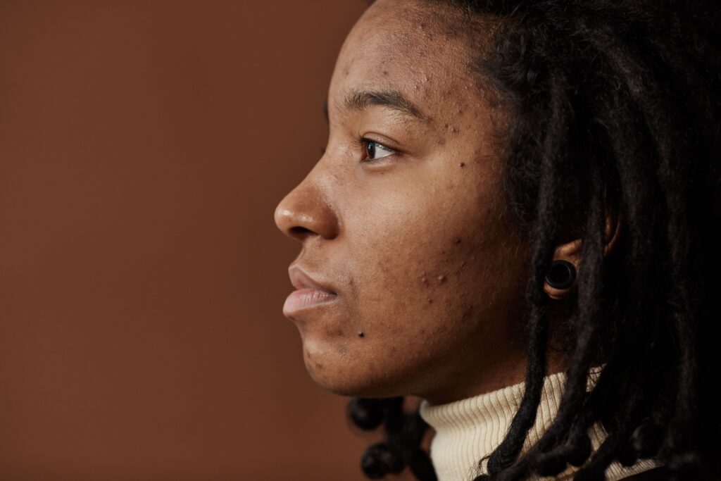 Profile portrait of a young woman with natural hair and visible skin texture.